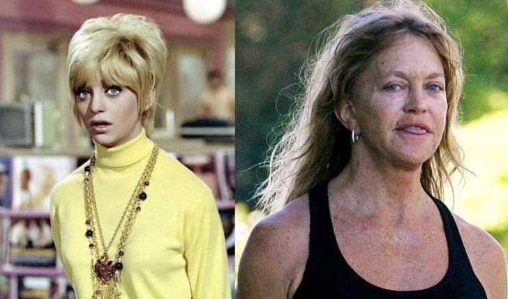 15 Celebrities Who Have Aged the Worst!