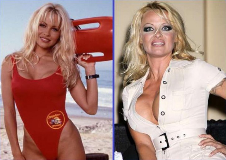 15 Celebrities Who Have Aged the Worst!